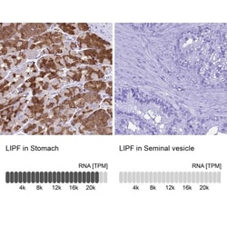 Gastric Lipase Antibody, Novus Biologicals 0.1mL; Unlabeled:Antibodies,